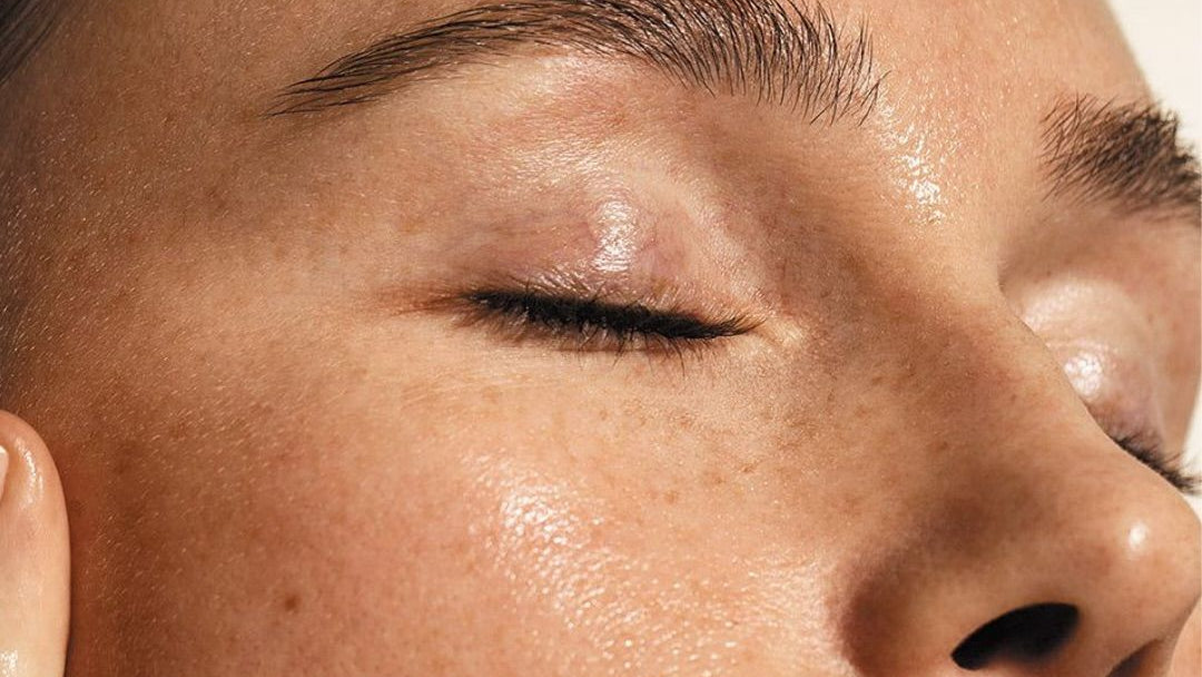 Rides, ridules, poches : Comprendre les besoins spécifiques du contour des yeux