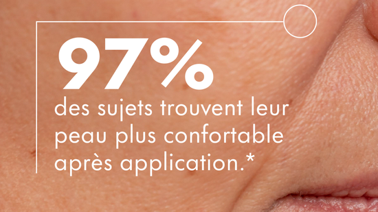 Peau sèche et sensible : comment éviter l’inconfort pendant le froid