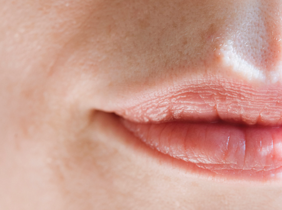 Quels sont les causes de rougeurs de ma peau ?