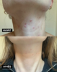 Sérum purifiant anti-imperfections